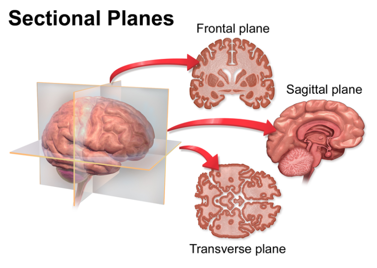 Brain Section